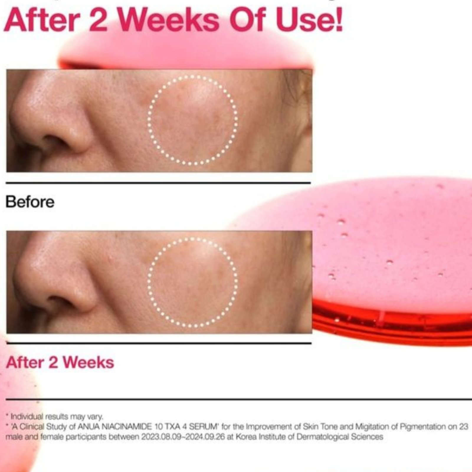Anua Niacinamide 10% + TXA 4% Dark Spot Correcting Serum - Image 3
